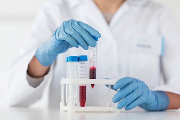 How To Manage Anemia Long Term