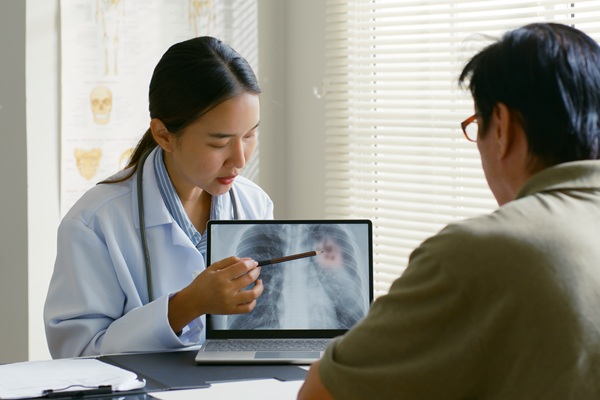 How Personalized Lung Cancer Treatment Plans Are Developed